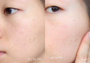 سرم ضد لک ایون باتر کلینیک 30 میل Clinique Even Better Clinical Radical Dark Spot Corrector  Interrupter Serum
